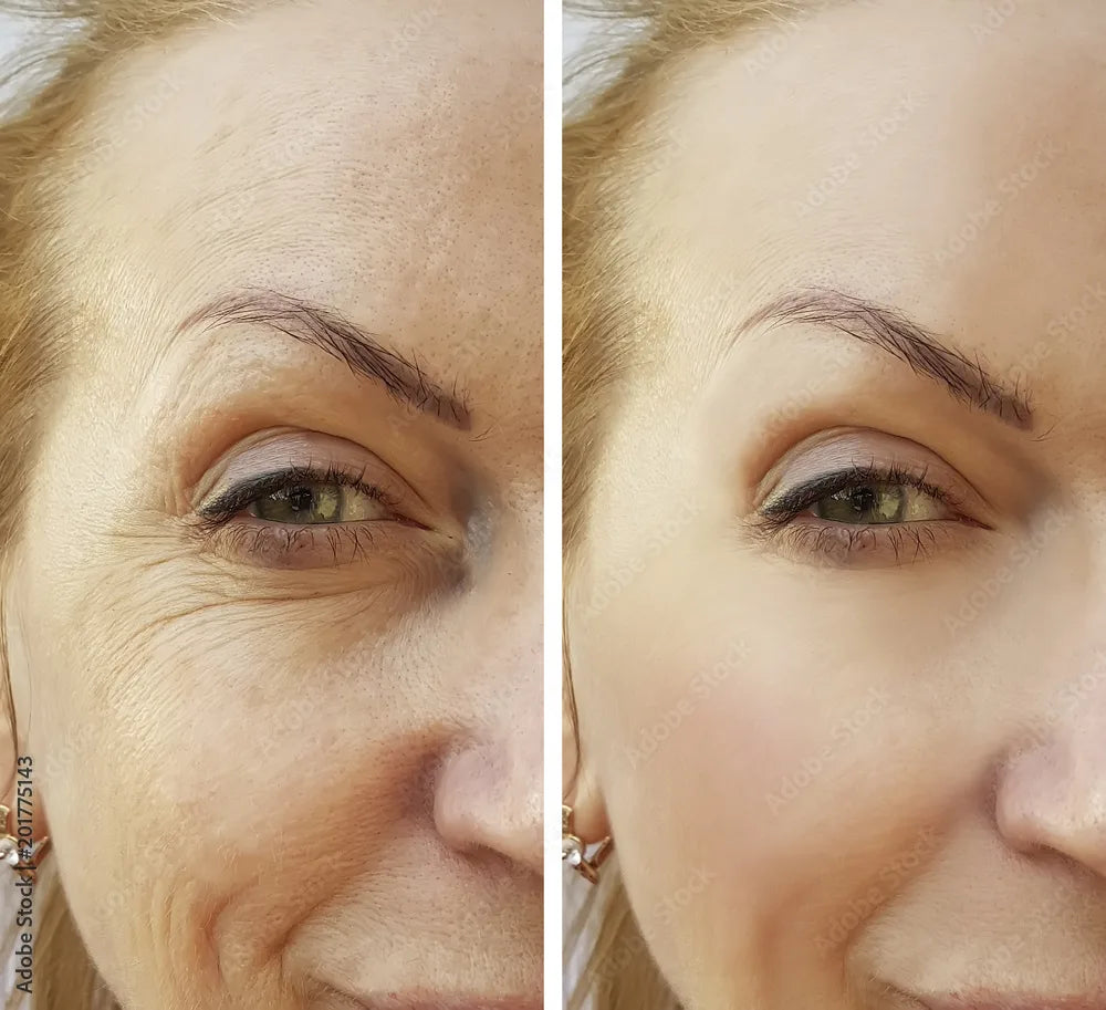 KAHI WRINKLE BOUNCE MULTI BALM