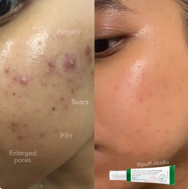 AXIS Y DARK SPOT CORRECTING GLOW SERUM