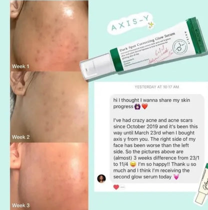 AXIS Y DARK SPOT CORRECTING GLOW SERUM