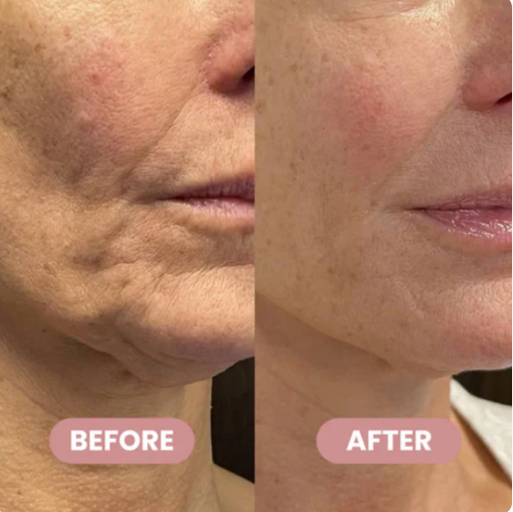 KAHI WRINKLE BOUNCE MULTI BALM